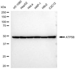 Invitrogen ATP Synthase beta Recombinant Rabbit Monoclonal Antibody (23GB3255),