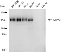 Invitrogen ATP7B Recombinant Rabbit Monoclonal Antibody (23GB3945), Invitrogen