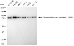 Invitrogen Phospho-GYS1 (Ser641) Recombinant Rabbit Monoclonal Antibody (23GB4070), Invitrogen 20 &mu;L | Buy Online | Invitrogen&trade; | Fisher Scientific