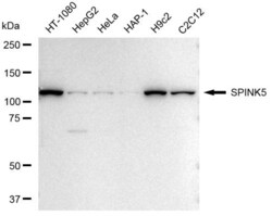 Invitrogen SPINK5 Recombinant Rabbit Monoclonal Antibody (23GB4180), Invitrogen