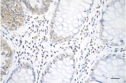 Invitrogen H3K18ac Recombinant Rabbit Monoclonal Antibody (23GB4465) 20 &mu;L | Buy Online | Invitrogen&trade; | Fisher Scientific