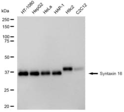 Invitrogen STX16 Recombinant Rabbit Monoclonal Antibody (23GB4655), Invitrogen
