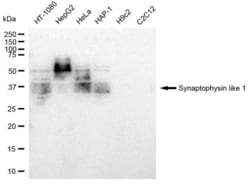 Invitrogen SYPL1 Recombinant Rabbit Monoclonal Antibody (23GB4675), Invitrogen
