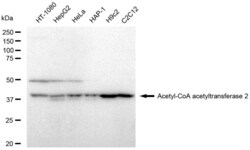 Invitrogen ACAT2 Recombinant Rabbit Monoclonal Antibody (23GB4745), Invitrogen