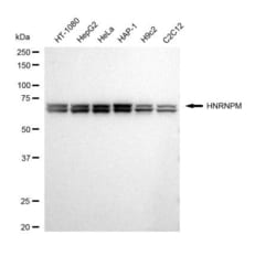 Invitrogen hnRNP M Recombinant Rabbit Monoclonal Antibody (23GB4895), Invitrogen