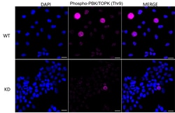 Invitrogen Phospho-PBK (Thr9) Recombinant Rabbit Monoclonal Antibody (23GB4910),