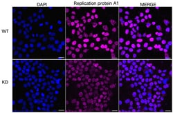 Invitrogen RPA70 Recombinant Rabbit Monoclonal Antibody (23GB4885), Invitrogen