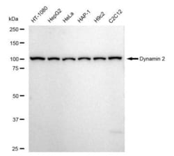 Invitrogen Dynamin 2 Recombinant Rabbit Monoclonal Antibody (23GB5170),