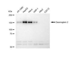 Invitrogen Desmoglein 2 Recombinant Rabbit Monoclonal Antibody (23GB5215),