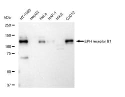 Invitrogen&trade;&nbsp;EphB1 Recombinant Rabbit Monoclonal Antibody (23GB5335)