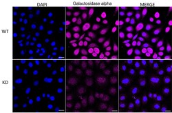 Invitrogen alpha Galactosidase Recombinant Rabbit Monoclonal Antibody (23GB5545) 20 &mu;L | Buy Online | Invitrogen&trade; | Fisher Scientific