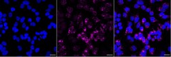 Invitrogen alpha Galactosidase Recombinant Rabbit Monoclonal Antibody (23GB5545) 20 &mu;L | Buy Online | Invitrogen&trade; | Fisher Scientific
