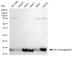 Invitrogen beta-2 Microglobulin Recombinant Rabbit Monoclonal Antibody
