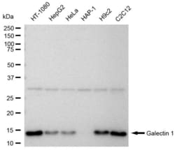 Invitrogen&trade;&nbsp;Galectin 1 Recombinant Rabbit Monoclonal Antibody (23GB6280)