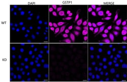 Invitrogen GSTP1 Recombinant Rabbit Monoclonal Antibody (23GB6420), Invitrogen