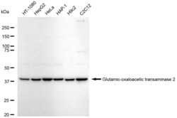Invitrogen GOT2 Recombinant Rabbit Monoclonal Antibody (23GB7985), Invitrogen