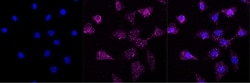 FOXO4 Recombinant Rabbit Monoclonal Antibody (23GB1470), Invitrogen:Antibodies,