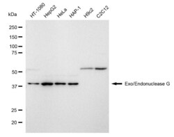 Invitrogen ENDOGL1 Recombinant Rabbit Monoclonal Antibody (23GB1370), Invitrogen