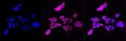 Invitrogen IRAK-M Recombinant Rabbit Monoclonal Antibody (23GB875), Invitrogen
