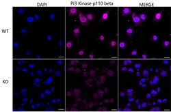 Invitrogen PIK3CB Recombinant Rabbit Monoclonal Antibody (23GB1035) 20 &mu;L | Buy Online | Invitrogen&trade; | Fisher Scientific
