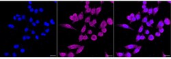 Invitrogen PIK3CB Recombinant Rabbit Monoclonal Antibody (23GB1035) 20 &mu;L | Buy Online | Invitrogen&trade; | Fisher Scientific