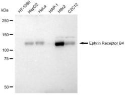 Invitrogen EphB4 Recombinant Rabbit Monoclonal Antibody (23GB1045), Invitrogen