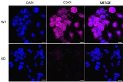 Invitrogen CDK4 Recombinant Rabbit Monoclonal Antibody (23GB745), Invitrogen