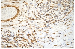 Invitrogen Alpha-Smooth Muscle Actin Recombinant Rabbit Monoclonal Antibody
