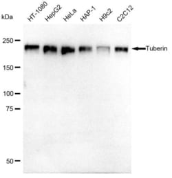 Invitrogen TSC2 Recombinant Rabbit Monoclonal Antibody (23GB1120), Invitrogen