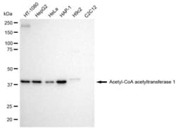 Invitrogen ACAT1 Recombinant Rabbit Monoclonal Antibody (23GB1255), Invitrogen