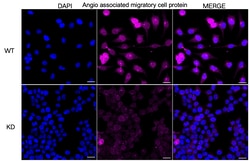 Invitrogen AAMP Recombinant Rabbit Monoclonal Antibody (23GB1885), Invitrogen