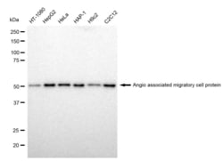 Invitrogen AAMP Recombinant Rabbit Monoclonal Antibody (23GB1885), Invitrogen