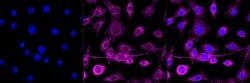 Invitrogen&trade;&nbsp;Arp3 Recombinant Rabbit Monoclonal Antibody (23GB615)