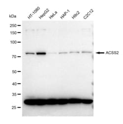 Invitrogen ACSS2 Recombinant Rabbit Monoclonal Antibody (23GB1705), Invitrogen
