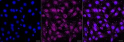 Invitrogen AKT1 Recombinant Rabbit Monoclonal Antibody (23GB1695) 20 &mu;L | Buy Online | Invitrogen&trade; | Fisher Scientific