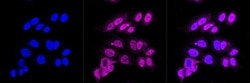 Invitrogen&trade;&nbsp;HIF-1 beta Recombinant Rabbit Monoclonal Antibody (23GB660)