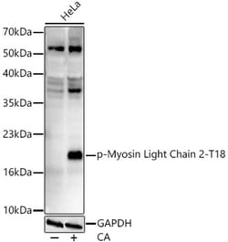 Invitrogen Phospho-MYL2 (Thr18) Recombinant Rabbit Monoclonal Antibody