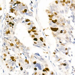 Invitrogen Phospho-Nucleolin (Thr76) Recombinant Rabbit Monoclonal Antibody (5V6R7) 100 &mu;L | Buy Online | Invitrogen&trade; | Fisher Scientific