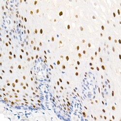 Invitrogen Phospho-Nucleolin (Thr76) Recombinant Rabbit Monoclonal Antibody (5V6R7) 100 &mu;L | Buy Online | Invitrogen&trade; | Fisher Scientific