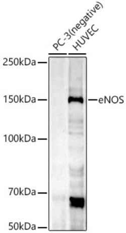 Invitrogen eNOS Recombinant Rabbit Monoclonal Antibody (8W3C2) 100 &mu;L | Buy Online | Invitrogen&trade; | Fisher Scientific