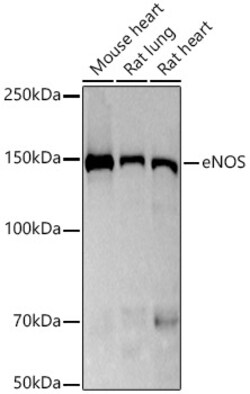 Invitrogen eNOS Recombinant Rabbit Monoclonal Antibody (8W3C2) 100 &mu;L | Buy Online | Invitrogen&trade; | Fisher Scientific