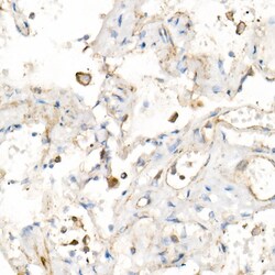 Invitrogen IL-15 Recombinant Rabbit Monoclonal Antibody (6R10Y9) 100 &mu;L;