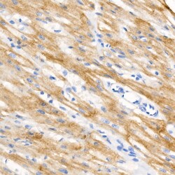 Invitrogen Phospho-Cardiac Troponin I (Ser23, Ser24) Recombinant Rabbit Monoclonal Antibody (9G7R2) 100 &mu;L | Buy Online | Invitrogen&trade; | Fisher Scientific