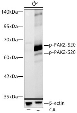 Invitrogen Phospho-PAK2 (Ser20) Recombinant Rabbit Monoclonal Antibody