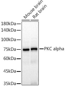 Invitrogen PKC alpha Recombinant Rabbit Monoclonal Antibody (5I10K3) 100 &mu;L | Buy Online | Invitrogen&trade; | Fisher Scientific