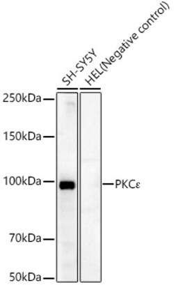 Invitrogen PKC epsilon Recombinant Rabbit Monoclonal Antibody (4T6M8) 100 &mu;L | Buy Online | Invitrogen&trade; | Fisher Scientific