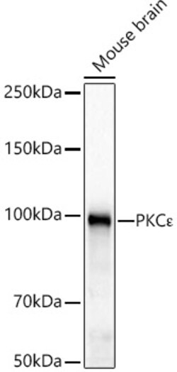 Invitrogen PKC epsilon Recombinant Rabbit Monoclonal Antibody (4T6M8) 100 &mu;L | Buy Online | Invitrogen&trade; | Fisher Scientific