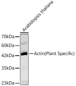 Invitrogen Actin Recombinant Rabbit Monoclonal Antibody (5M5Z8) 100 &mu;L | Buy Online | Invitrogen&trade; | Fisher Scientific