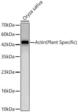 Invitrogen Actin Recombinant Rabbit Monoclonal Antibody (5M5Z8) 100 &mu;L | Buy Online | Invitrogen&trade; | Fisher Scientific