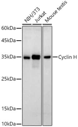 Invitrogen Cyclin H Recombinant Rabbit Monoclonal Antibody (2Z8X3) 100